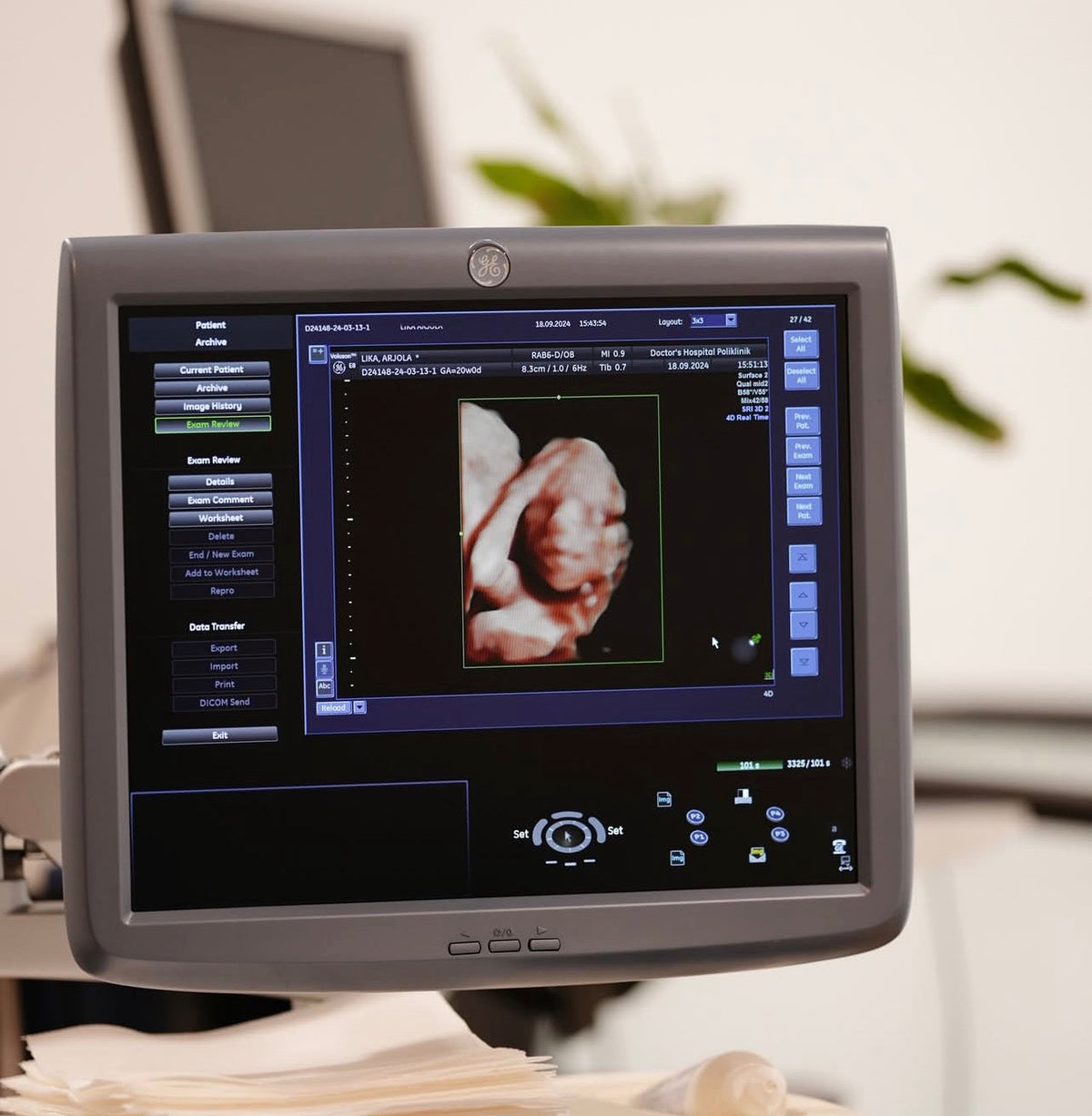 Treatments offered by Department of Gynecology & Obstretics