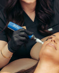 Skinpen Microneedling