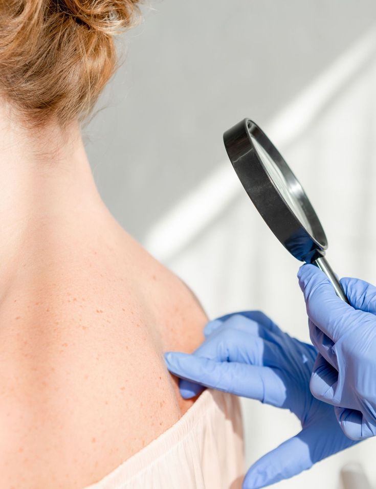 Dermatologic consultation